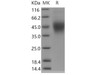 Human FcERI/FCER1A Recombinant Protein (RPES0852)
