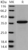 Human PDE9A Recombinant Protein (His Tag) (RPES0858)