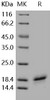 Human CD40L/TNFSF5 Recombinant Protein (RPES0859)