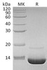 Complement Component C3a/C3a Recombinant Protein (RPES0860)