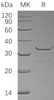 Human SULT1B1 Recombinant Protein (His Tag) (Active) (RPES0872)