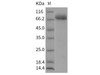 Rat EphA4 Recombinant Protein (RPES0875)