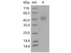 Mouse NEGR1 Recombinant Protein (His Tag) (RPES0876)