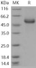 Human HAI/SPINT1 Recombinant Protein (RPES0877)