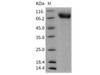Mouse TrkA/NTRK1 Recombinant Protein (His Tag) (Active) (RPES0883)