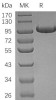 Complement Factor B/CFB Recombinant Protein (RPES0897)