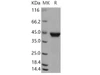 Human RRM2B/P53R2 Recombinant Protein (His Tag) (RPES0908)