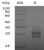 Mouse GM-CSF/CSF2 Recombinant Protein (RPES0920)