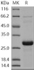 Human SNAP25/SUP Recombinant Protein (His Tag) (RPES0927)