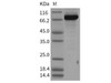 Human PBEF/NAMPT Recombinant Protein (His & GST Tag) (RPES0932)