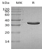 Human IA2/PTPRN Recombinant Protein (RPES0934)