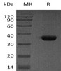 Human Osteonectin/SPARC Recombinant Protein (RPES0953)