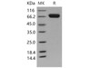 Mouse EphA7/EHK3 Recombinant Protein (RPES0967)