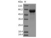 Mouse CREG/CREG1 Recombinant Protein (Fc Tag) (RPES0974)