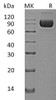Human ILRAcP/IL1R3 Recombinant Protein (RPES0989)