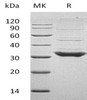 Human TOLLIP Recombinant Protein (RPES0991)