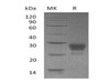 Human TNFSF4/OX40L Recombinant Protein (RPES1007)