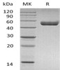 Mouse CD74 Recombinant Protein (RPES1010)