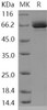 Human EphB1/EPHT2 Recombinant Protein (aa 565-984, His & GST Tag) (Active) (RPES1015)
