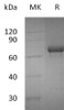 Human OX40/TNFRSF4 Recombinant Protein (RPES1023)