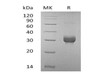 Mouse Noggin/NOG Recombinant Protein (RPES1029)