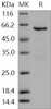 Human MUSK Kinase Recombinant Protein (aa 433-783, His & GST Tag) (RPES1030)