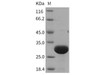 Rat UCHL3/UCH-L3 Recombinant Protein (His Tag) (Active) (RPES1035)
