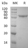 Human OX40/TNFRSF4 Recombinant Protein (RPES1040)