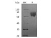 Human LFA-3/CD58 Recombinant Protein (RPES1046)