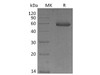 Mouse NGAL/Lipocalin-2 Recombinant Protein (RPES1047)