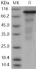 Human ERN1/IRE1 Recombinant Protein (aa 465-977, His & GST Tag) (Active) (RPES1048)