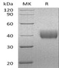 Human Mesothelin/MSLN Recombinant Protein (His Tag) (RPES1049)