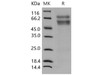 Mouse CHST3/C6ST Recombinant Protein (His Tag) (RPES1053)