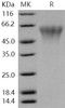 Human TREML2/TLT2 Recombinant Protein (His Tag) (RPES1054)