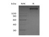 Human TRAIL R3/TNFRSF10C Recombinant Protein (RPES1059)