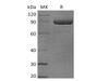 Human LAG3/CD223 Recombinant Protein (RPES1064)