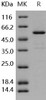 Human CNDP2/CPGL/PEPA Recombinant Protein (RPES1070)