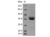 Rat IL9R/Interleukin 9 receptor Recombinant Protein (His Tag) (RPES1071)