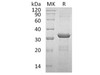 Human Coronin-6/CORO6 Recombinant Protein (RPES1074)