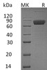 Human IL10RB/IL10R2 Recombinant Protein (RPES1075)