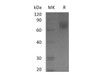 Human EGFR/ErbB1 Recombinant Protein (RPES1082)