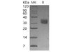 Mouse Mesothelin/MSLN Recombinant Protein (RPES1103)