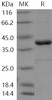 Human PTPN12 Recombinant Protein (Active) (RPES1106)