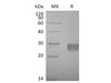 Mouse IGFBP6/IGFBP-6 Recombinant Protein (RPES1117)