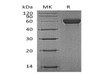 Mouse MARCO Recombinant Protein (RPES1122)