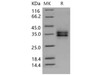 Mouse FOLR1 Recombinant Protein (aa 1-231, His Tag) (RPES1129)