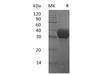 Mouse MGL2/CD301b Recombinant Protein (RPES1142)