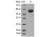 Human DDR1 Kinase/MCK10 Recombinant Protein (His Tag) (RPES1146)