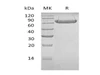 Human LAG3/CD223 Recombinant Protein (RPES1159)