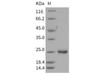 Rat LCN2/NGAL Recombinant Protein (His Tag) (Active) (RPES1166)